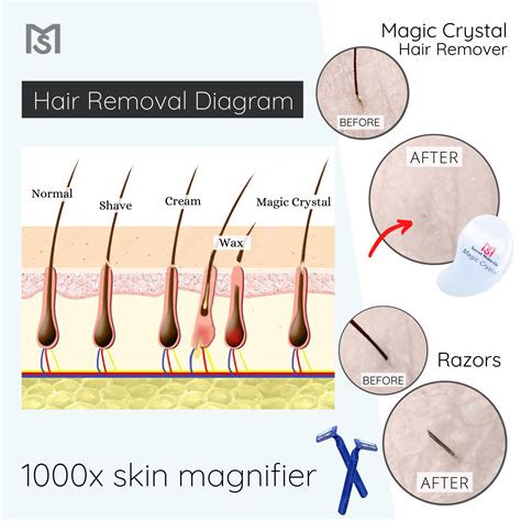 Magic crgatal hair remover